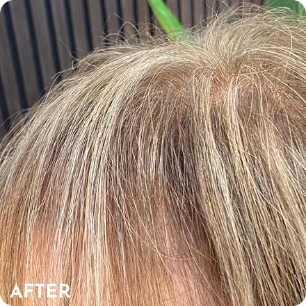 Hair Skin After