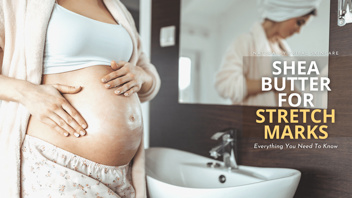 Shea Butter For Stretch Marks (Helpful Guide)