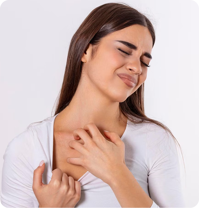 Eczema & Irritated Skin