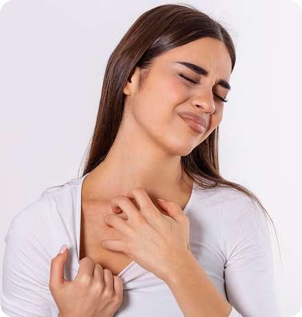 Eczema Irritated Skin - Naturally Tiwa Skincare