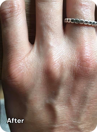 Finger After