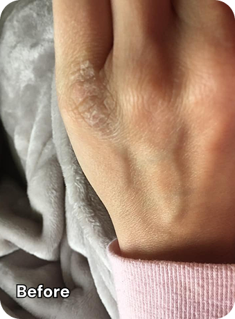 Finger Before