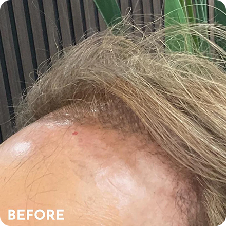 Hair Skin Before