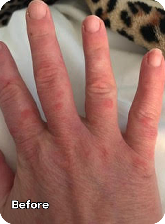 Hand Before