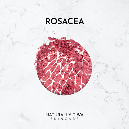 Naturally Tiwa Skincare IYA Body Food 90ml sensitive skin, eczema, psoriasis, rosacea, skin undergoing chemotherapy and radiotherapy and dry skin conditions.