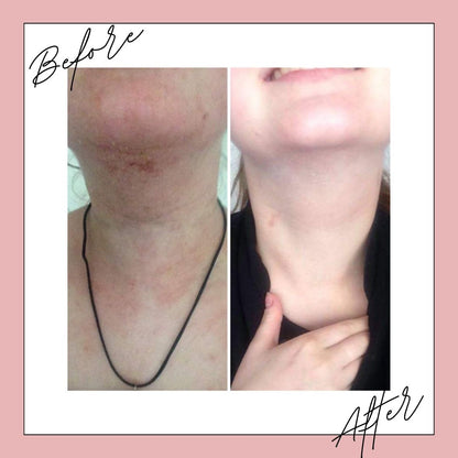 Naturally Tiwa Skincare IYA Body Food 90ml sensitive skin, eczema, psoriasis, rosacea, skin undergoing chemotherapy and radiotherapy and dry skin conditions.