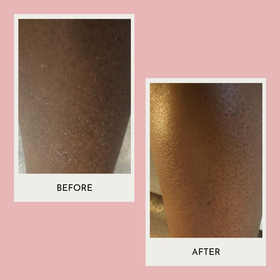 Naturally Tiwa Skincare IYA Body Food 90ml sensitive skin, eczema, psoriasis, rosacea, skin undergoing chemotherapy and radiotherapy and dry skin conditions.