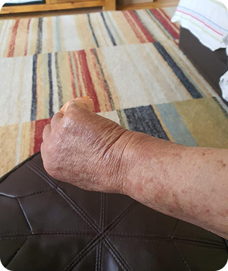 Real Skin hand before - Naturally Tiwa Skincare