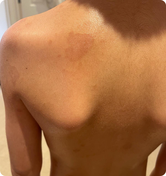 Transforming Skin After