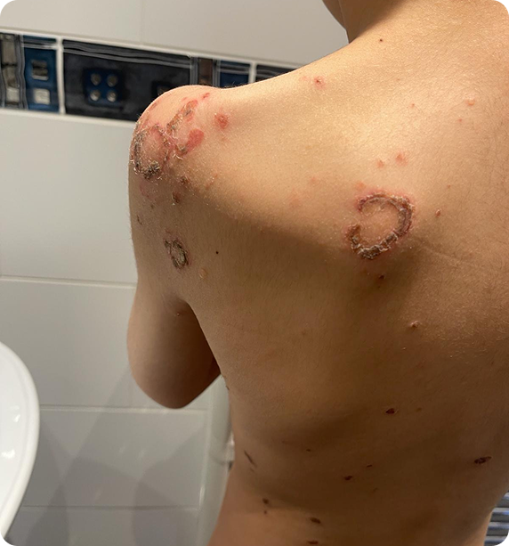 Transforming Skin Before